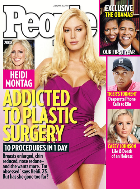 heidi montag surgery people. Heidi Montag plastic surgery