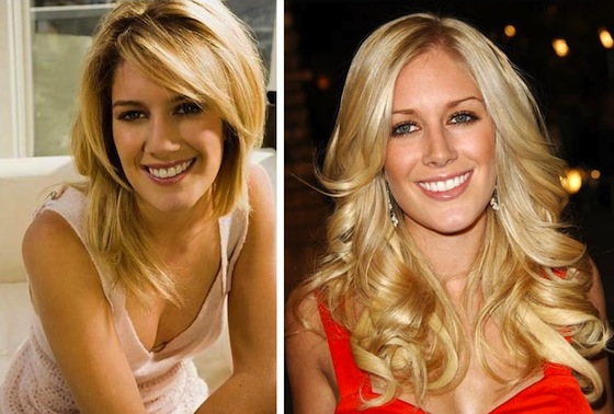 heidi montag before and after plastic. Heidi Montag#39;s dad, Bill,